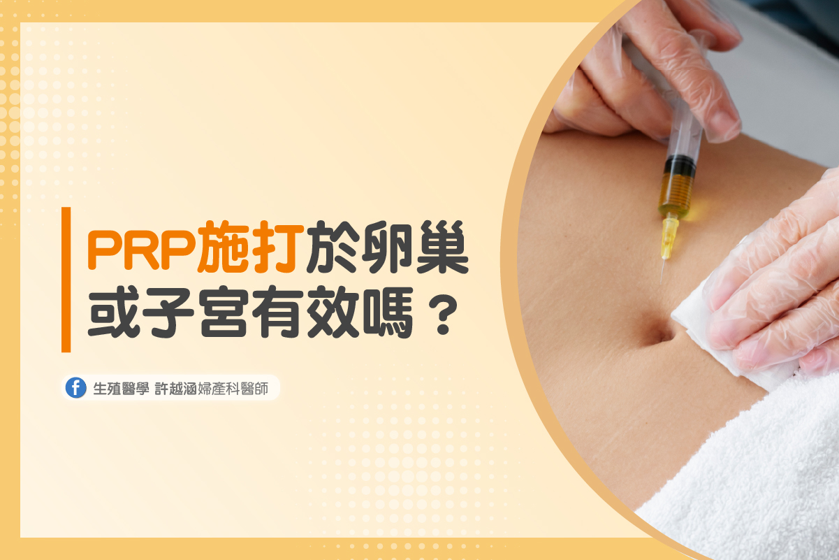PRP施打於卵巢或子宮有效嗎?來自五篇學術研究的探討 PRP施打於卵巢或子宮有效嗎?來自五篇學術研究的探討 - 生殖醫學| 許越涵婦產科醫師