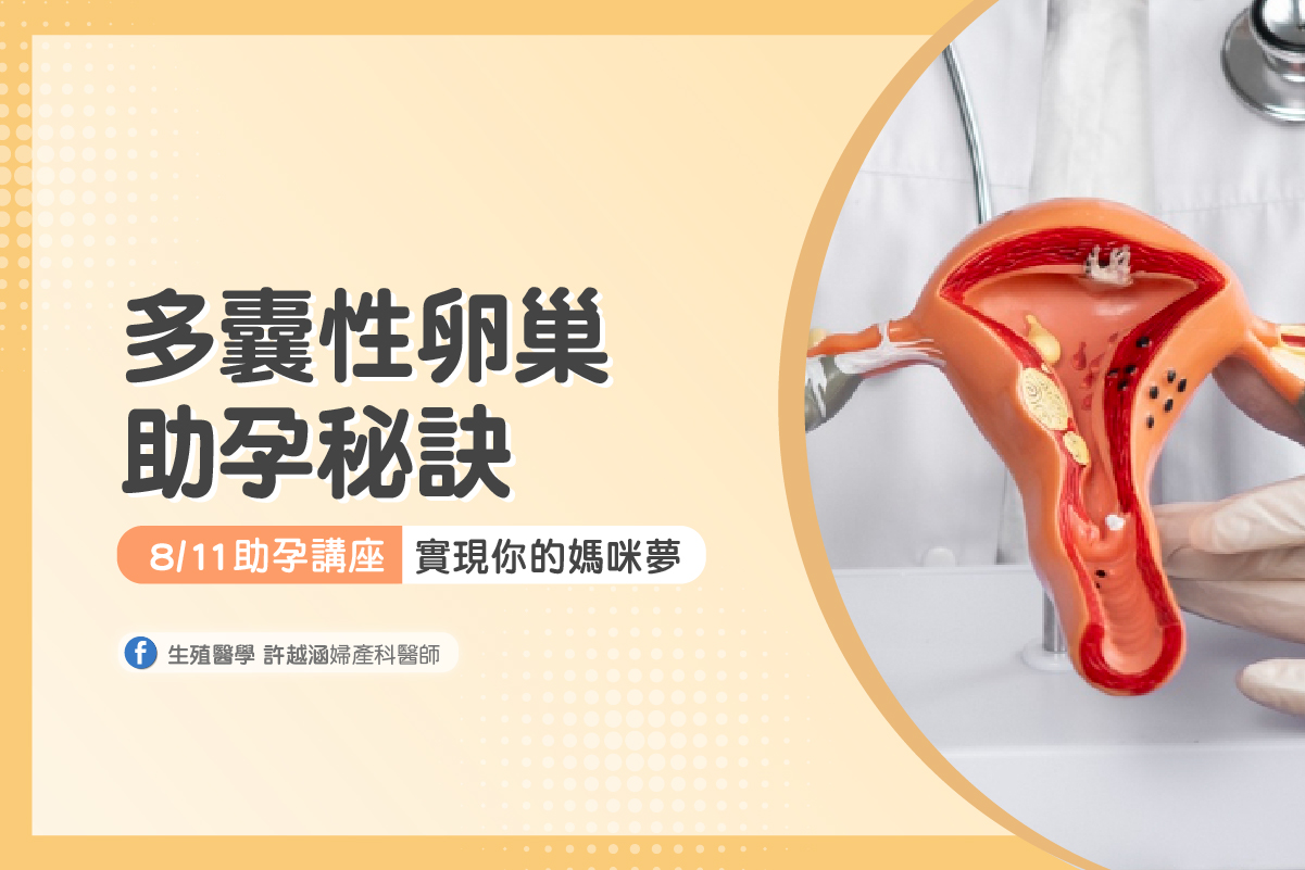 我患有 PCOS而且想要懷孕，我需要知道的n件事？ - 生殖醫學｜ 許越涵婦產科醫師