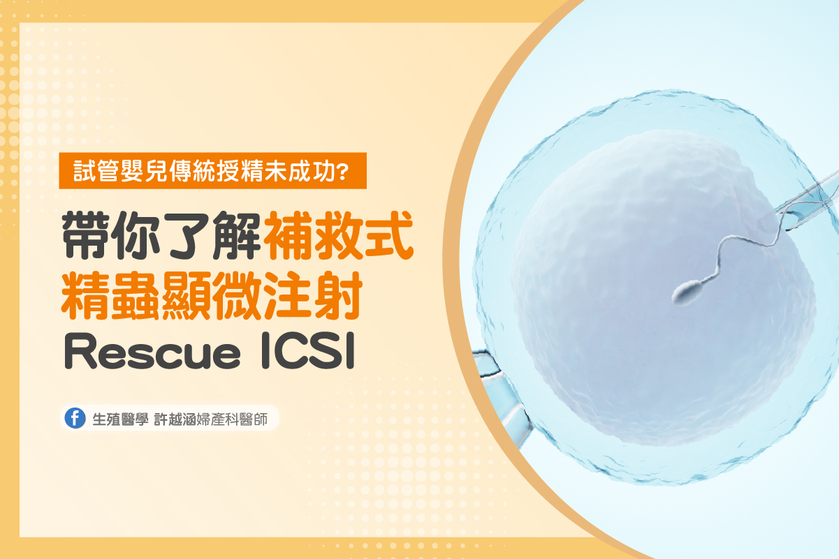 試管嬰兒傳統授精未成功?補救式精蟲顯微注射的4大優勢 補救式精蟲顯微注射