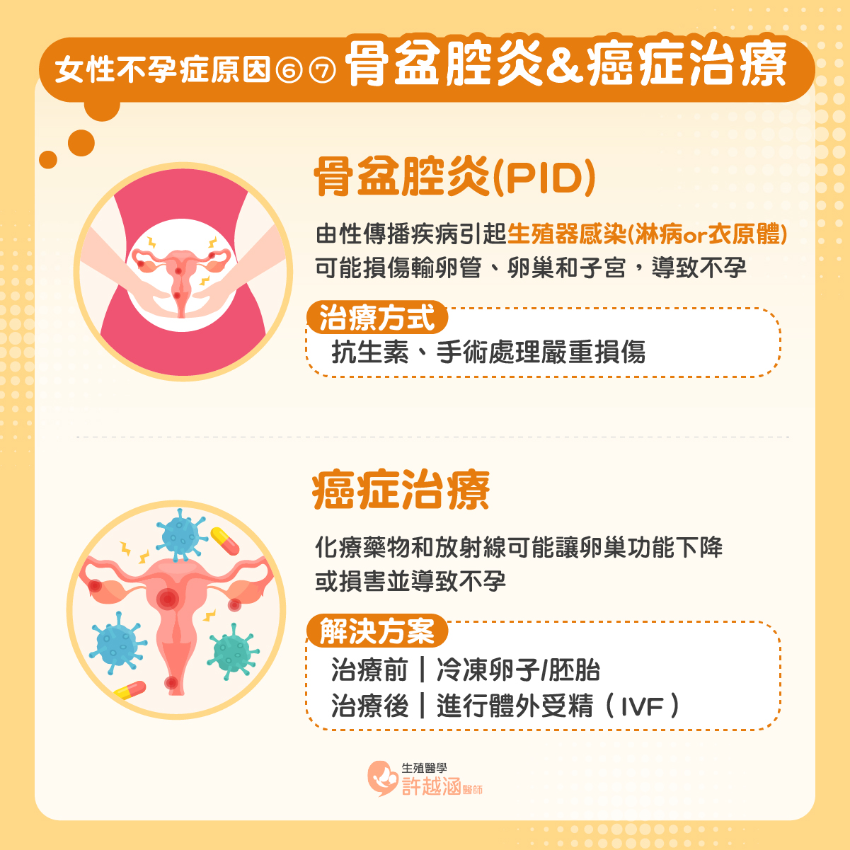 骨盆腔炎 癌症治療